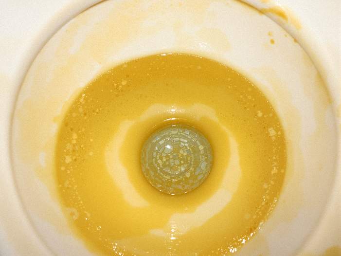 尿石付着前の便器