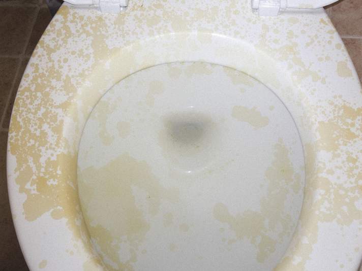 黄ばみ付着前の便器